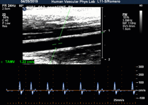 A screen shows a black and white medical image