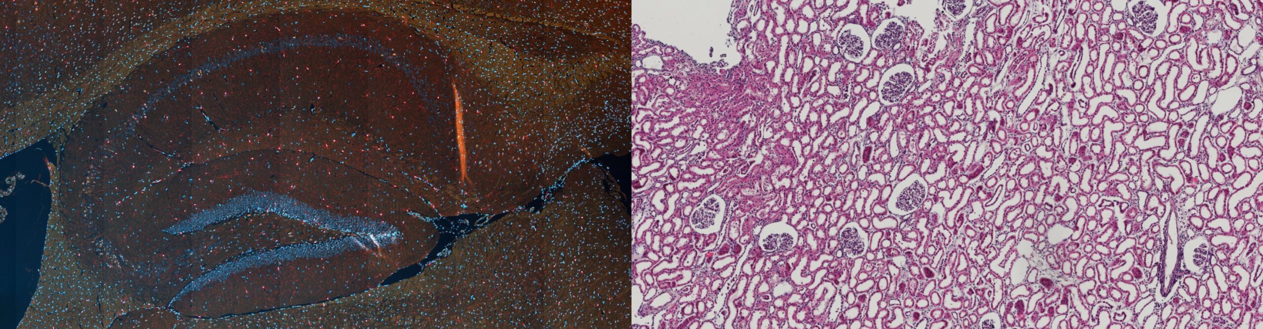 Left Side:  Mouse Brain/Right Side: Kidney stained with Hematoxylin and Eosin