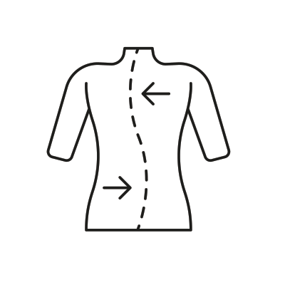 Patient's back with arrows showing spine curves